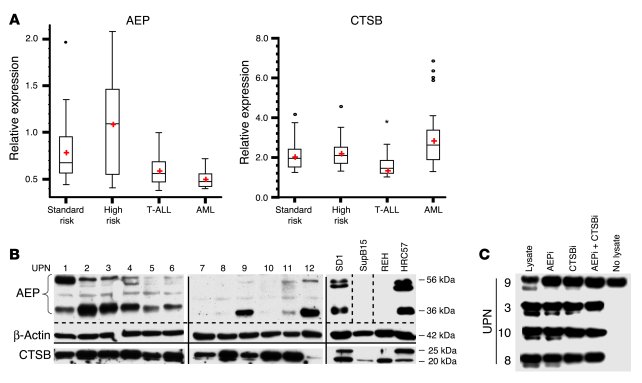 AEP is relatively overexpressed in cytogenetic high-risk subsets of pre-...