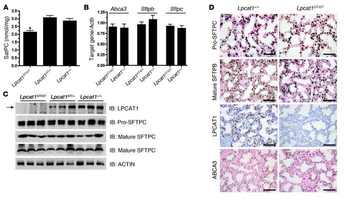 Lung SatPC content is decreased in E18.5 Lpcat1GT/GT mice.
   
(A) Measu...