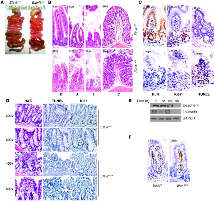 Role of HuR in intestinal integrity and progenitor cell survival.
(A) Ab...