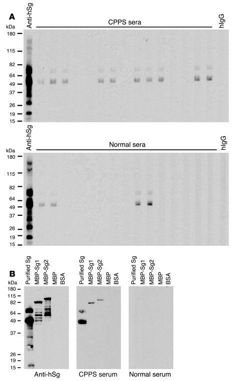 CPPS patients possess autoimmune response to human Sg.
(A) Immunoblottin...