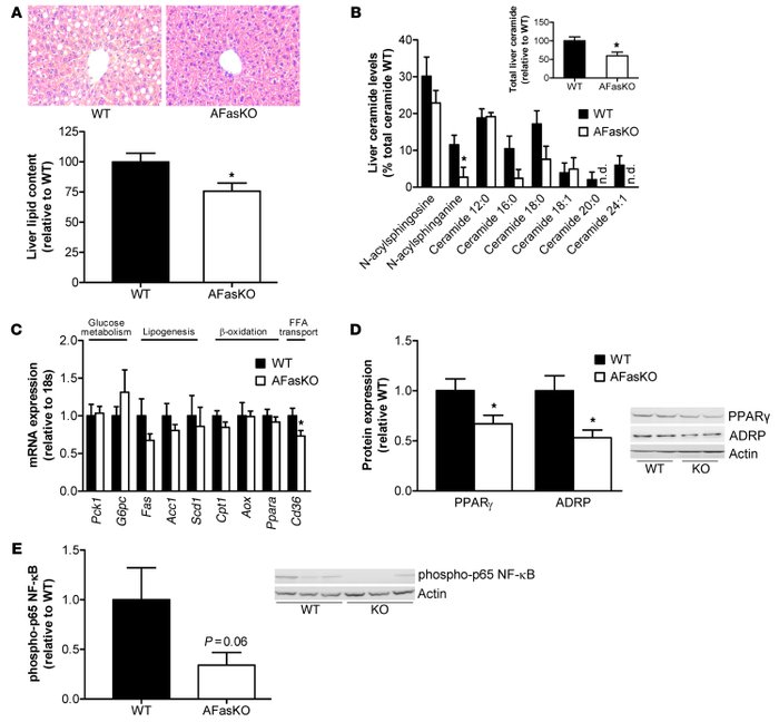 Reduced hepatic steatosis in HFD-fed AFasKO mice.
(A) H&amp;E-stained li...