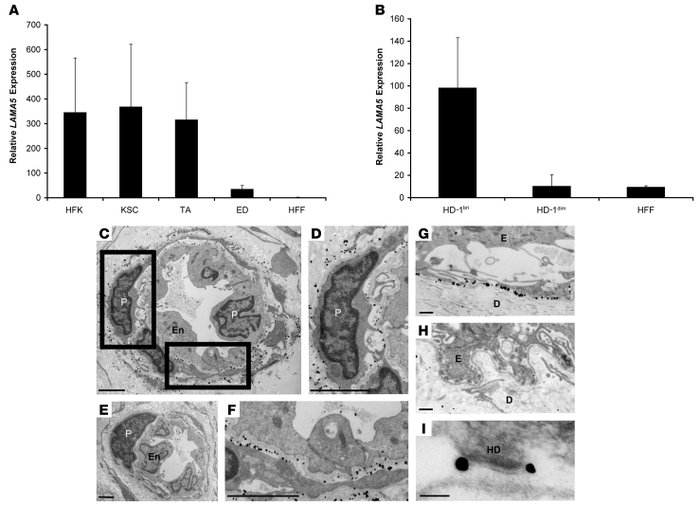 Human dermal pericytes synthesize and secrete LAMA5 in the skin.
(A) Qua...