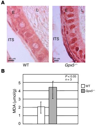 The cauda epididymidis epithelium of Gpx5–/– animals suffers from oxidat...