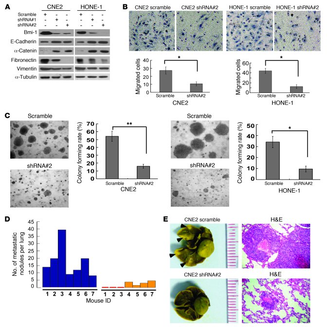 Suppression of endogenous Bmi-1 expression in NPC cells reverses EMT and...