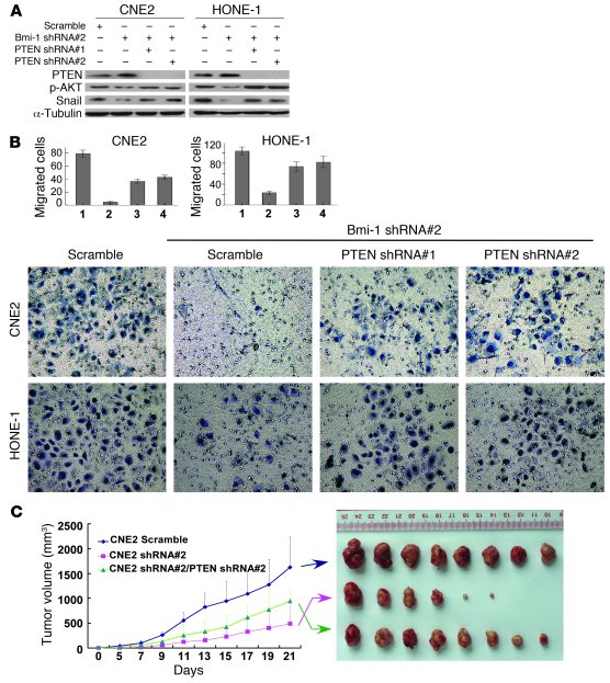 Inhibition of PTEN expression by shRNA rescues migration/invasiveness an...