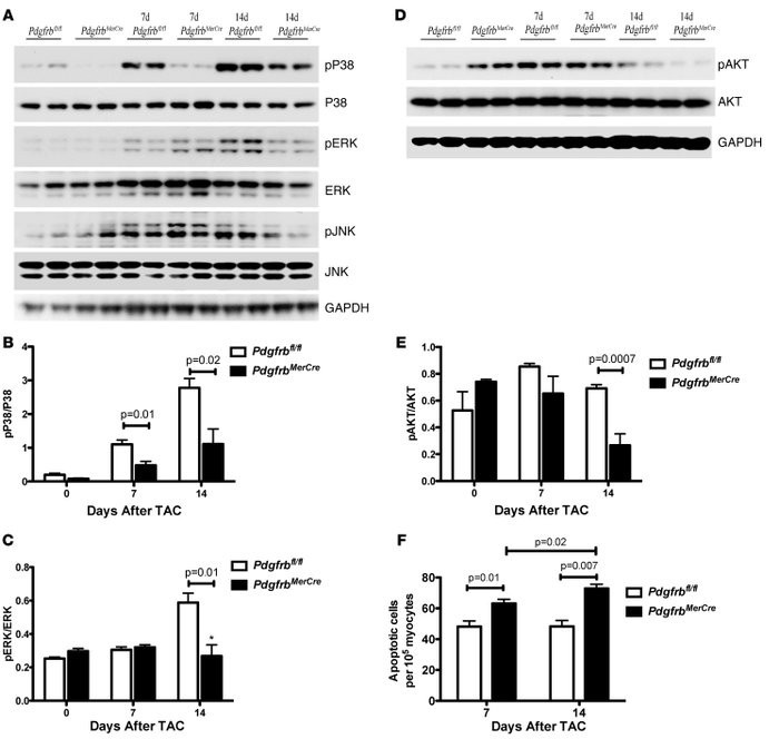 Inducible, cardiac-specific PDGFR-β–knockout mice exhibit impaired activ...