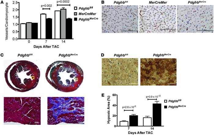 Impaired angiogenesis and evidence of ischemic injury in the hearts of i...