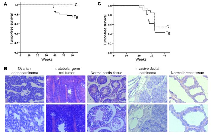 Spontaneous tumorigenesis in Nlp transgenic mice.
(A) Both normal and Nl...