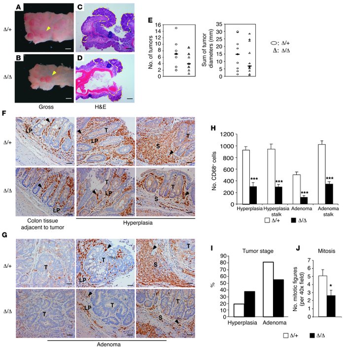 Loss of TAM HIF-2α leads to reduced tumor burden and progression in muri...