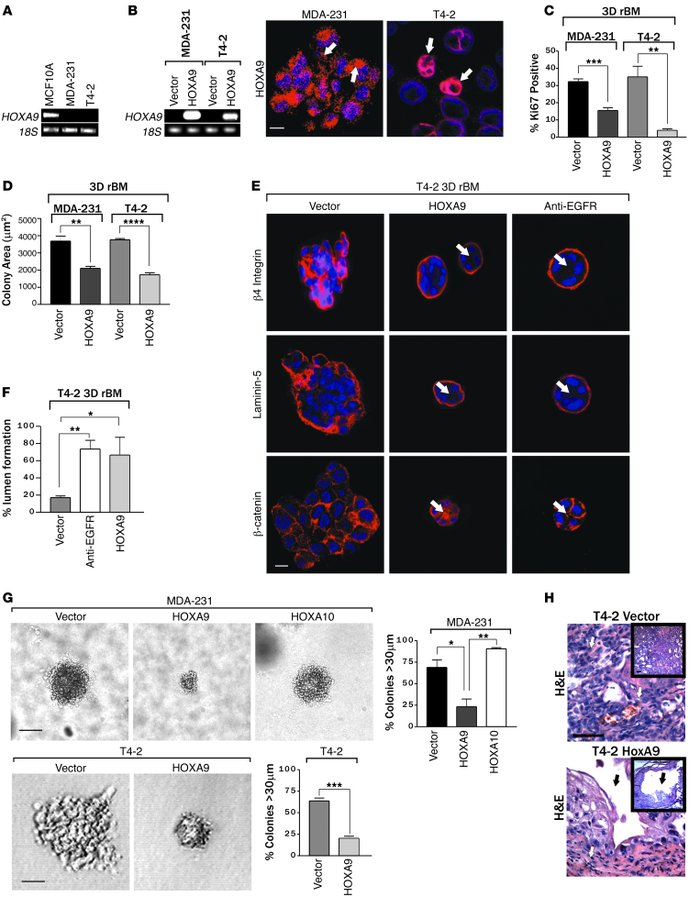 HOXA9 modulates the growth and survival of breast cancer cells.
(A) Semi...