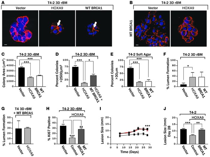 HOXA9 regulates BRCA1 to repress the malignant behavior of MECs.
(A) Imm...