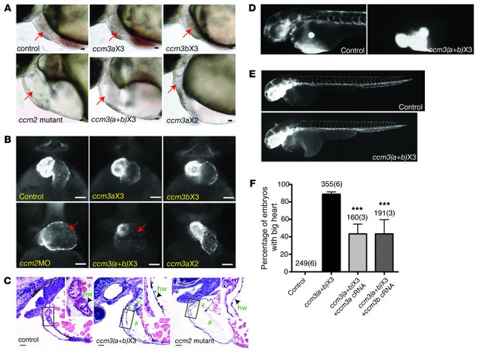 JCI - CCM3 signaling through sterile 20–like kinases plays an essential ...