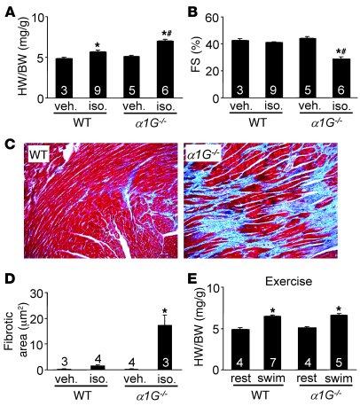 α1G deletion exacerbates cardiac pathology after isoproterenol infusion....
