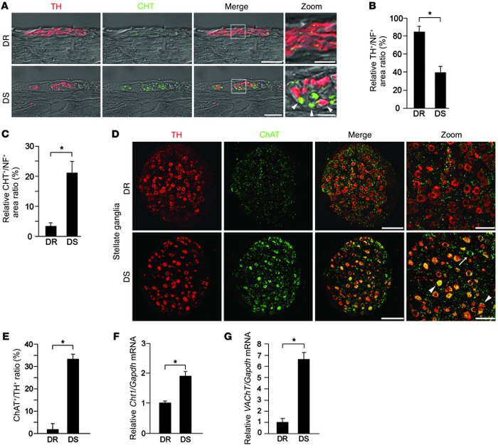 Cardiac nerve fibers and stellate ganglia neurons in DS rat ventricles h...