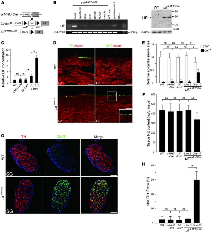 Cardiac-specific overexpression of LIF induces neurotransmitter switchin...