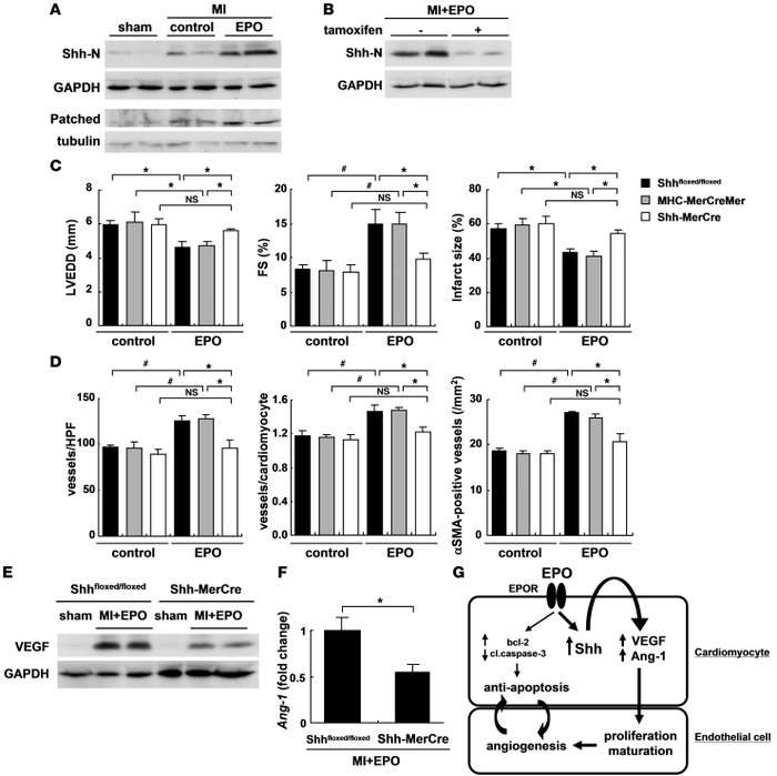 Cardiomyocyte-specific Shh deletion abolishes EPO-induced cardioprotecti...