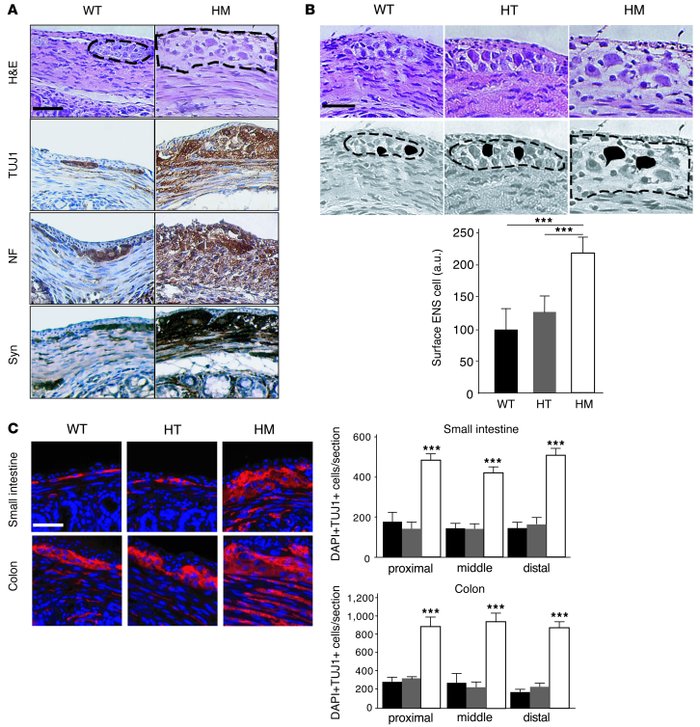 Hyperplasia and hypertrophy of HM ENCs.
(A) Transverse sections of WT an...