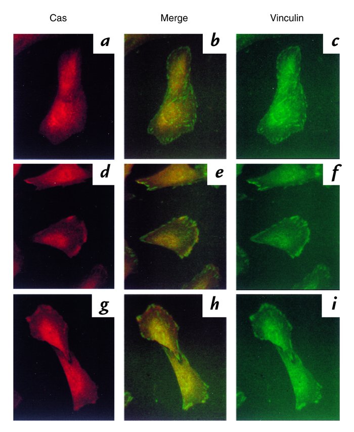 Translocation of Cas by stimulation of thrombin and angII in VSMCs. Seru...