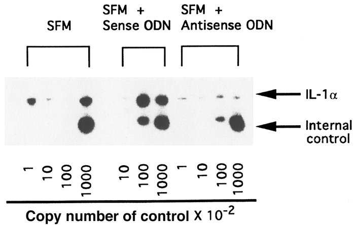 Quantitative RT-PCR of IL-1α mRNA derived from fibroblasts in patients w...