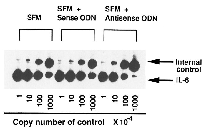 Representative results of quantitative RT-PCR of IL-6 mRNA derived from ...