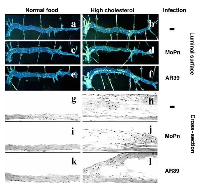 Representative images of mouse aortic luminal surface (top) and aorta ar...