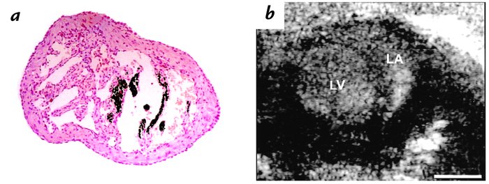 Left atrial pathology at postnatal day 6 in α-MHC403/403 mice. (a) Cut s...