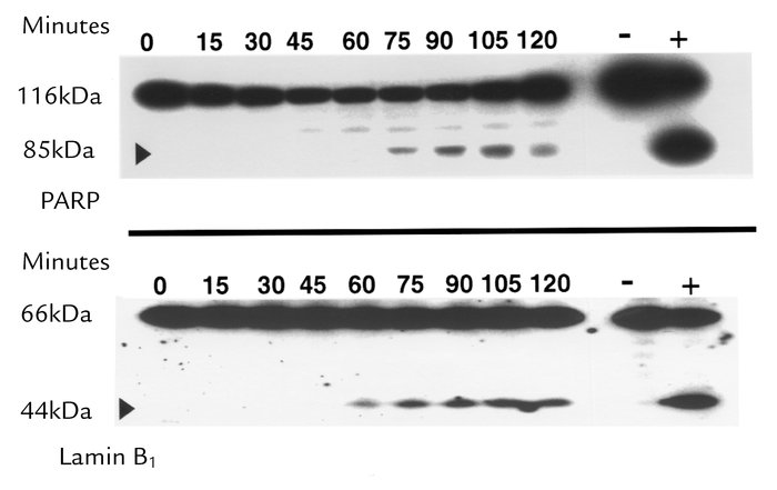 Immunoblot analysis shows PARP and lamin B1 cleavage. McNtpc.24 cells we...