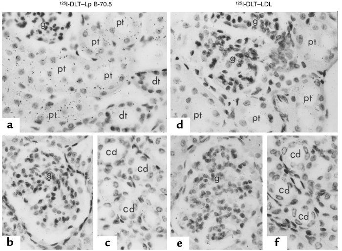 Autoradiograms of renal tissues from rabbits 24 hours after injection of...