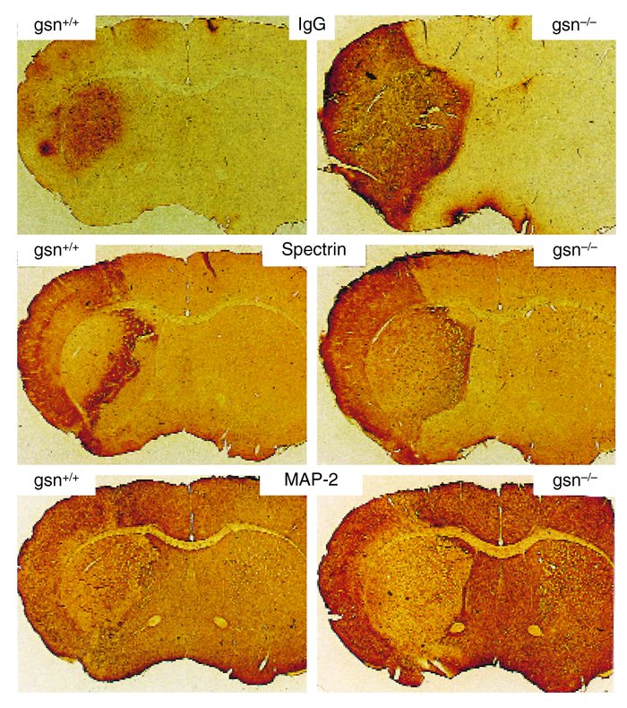 Evidence for increased Ca2+-mediated proteolysis following MCA occlusion...