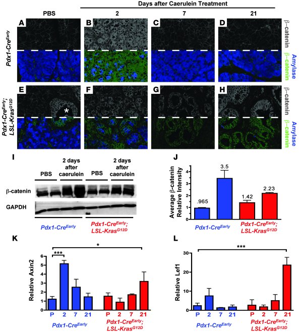 Regeneration-associated reactivation of β-catenin signaling is inhibited...