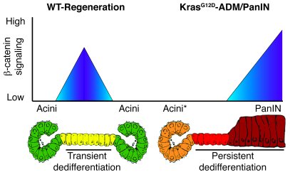 β-catenin acts as a gatekeeper of Kras-induced reprogramming of acini in...