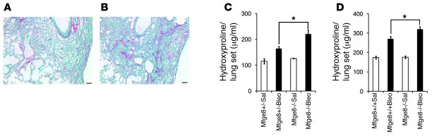
Mfge8–/– mice develop exaggerated pulmonary fibrosis after injury.
   
...