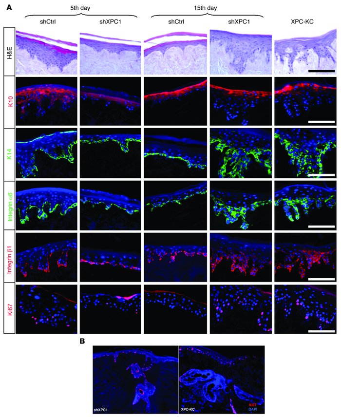 Knockdown of XPC results in epithelial hyperplasia.
Epidermis reconstruc...
