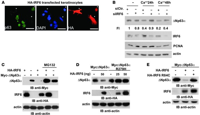 IRF6 induces downregulation of ΔNp63 in human primary keratinocytes.
(A)...