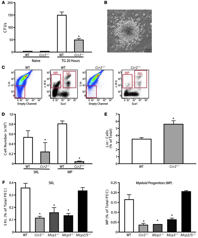 CCR2 mediates the recruitment of HSCs/HPCs to the peritoneum.
(A) Thiogl...