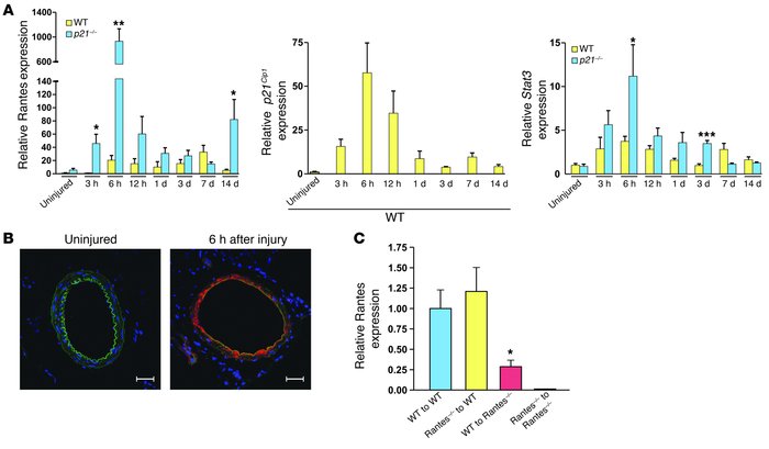 Rantes production is acutely upregulated following arterial injury and p...