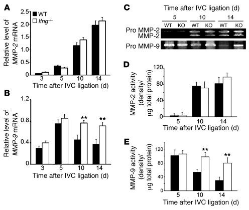 Intrathrombotic MMP-2 and MMP-9 expression.
(A and B) Intrathrombotic ge...