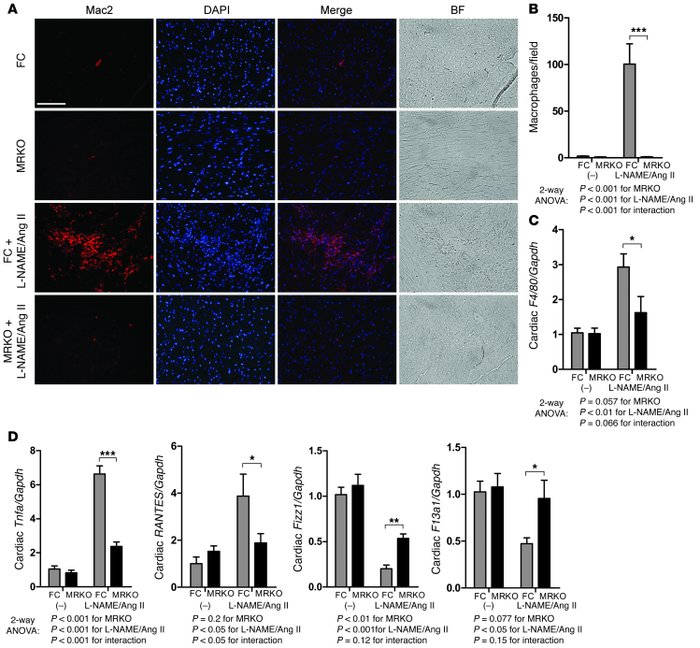 MyMRKO reduces L-NAME/Ang II–induced interstitial macrophage recruitment...