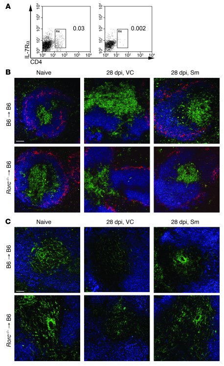 Restoration of splenic architecture after RTKI treatment is not dependen...