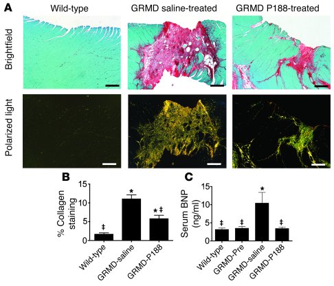 Chronic P188 treatment limits myocardial fibrosis and blocks elevation i...