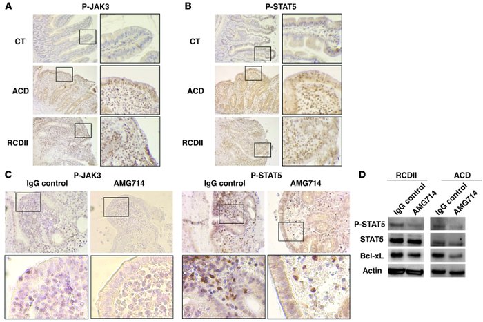 IL-15–dependent phosphorylation of Jak3 and STAT5 in RCDII and ACD.
(A a...