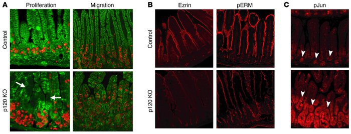 Inflammation-associated field effects in p120 KO tissue.
(A) p120 KO and...