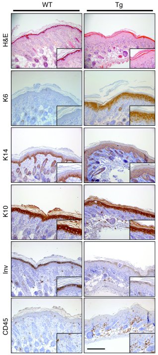 Alteration of the epidermal differentiation program in Tg-ELA2 animals.
...