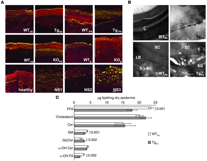 Abnormal epidermal lipid organization and quantification.
(A) Nile red s...