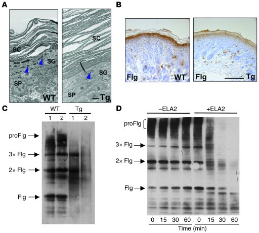 (Pro-)filaggrin is a target of ELA2.
(A) Ultrastructural analysis of 4-d...