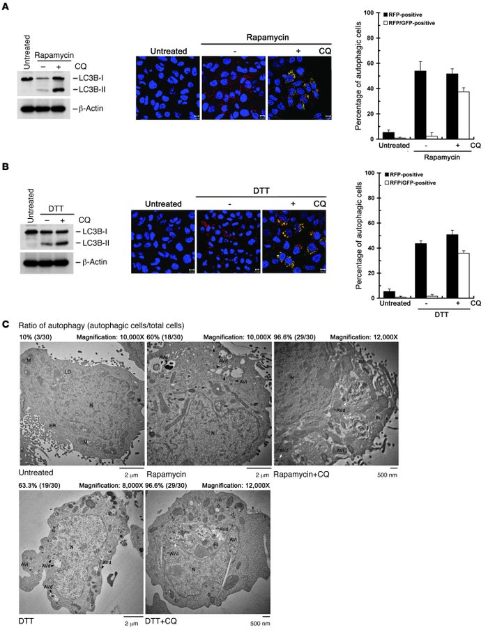 Effect of CQ on rapamycin- and DTT-triggered autophagic process.
(A–C) H...