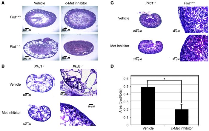 A c-Met inhibitor decreased the size and number of cysts in Pkd1–/– kidn...