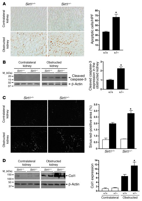 Sirt1 deficiency is associated with increased apoptosis and fibrosis in ...