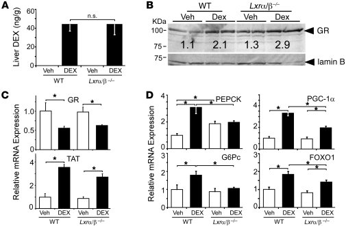 Selective regulation of GR target genes in Lxrα/β–/– mice treated with D...