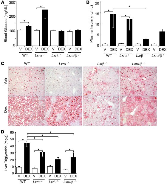 
Lxrβ–/– mice are resistant to developing GC-induced hyperglycemia, hype...